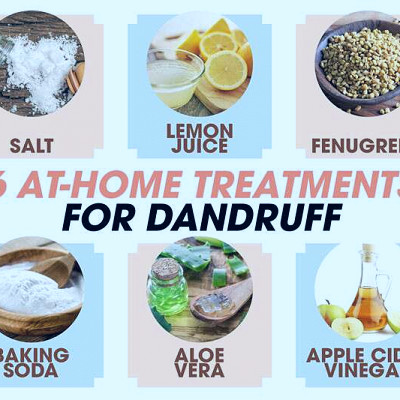 Top At-Home Treatments For Dandruff | Femina.in